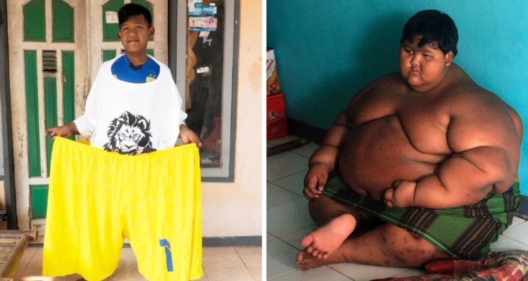 Arya Permana fue considerado el niño más gordo del mundo, luego de que a sus 9 años pesara 190 kilos. Actualmente, gracias a un nuevo estilo de vida y hábitos, su cambio es considerable.