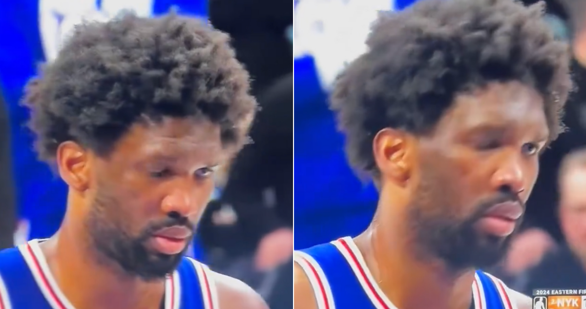 Joel Embiid la rompe a pesar de presentar una parálisis facial.