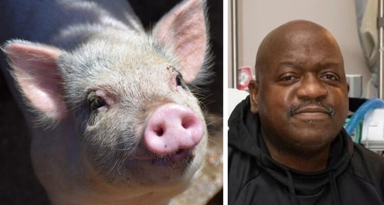 Rick Slayman, el hombre que recibió un trasplante de un riñón de cerdo modificado genéticamente murió meses después de la operación.
