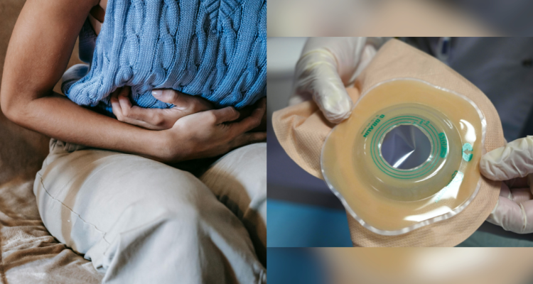 Día de las Enfermedades Inflamatorias Intestinales: lo relevante del diagnóstico y atención adecuada