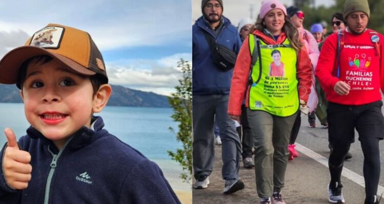 Así es la Distrofia Muscular de Duchenne: la grave condición de Tomás que tiene tratamiento millonario