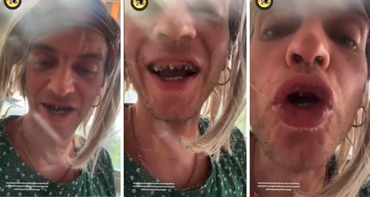 El hijo de Camilo Sesto, Camilo Blanes, se mostró en un video con un aspecto deteriorado: dientes dañados, labios partidos y hablando con incoherencias.