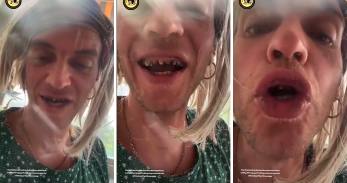 El hijo de Camilo Sesto, Camilo Blanes, se mostró en un video con un aspecto deteriorado: dientes dañados, labios partidos y hablando con incoherencias.