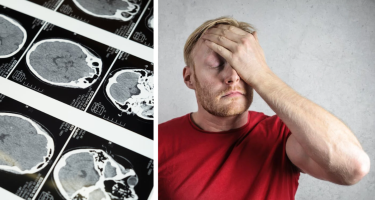 ¿Cómo llega un gusano a tu cerebro y cómo puedes saber si tienes uno?