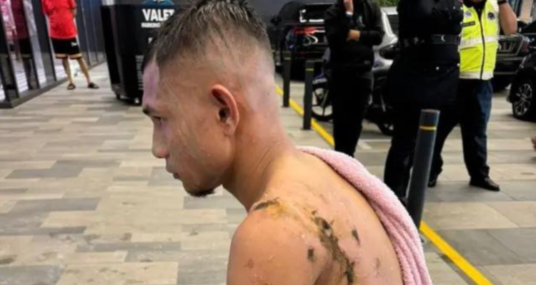 Jugador malasio es rociado con ácido en violento asalto.