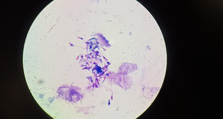 Encuentran microplásticos en testítulos de humanos y perros: podrían estar afectando a la reproducción