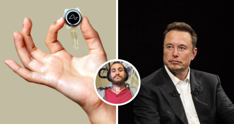 Según una de las últimas actualizaciones, el implante cerebral de Neuralink en, Noland Arbaugh, sufrió un problema, pero logró solucionarse.