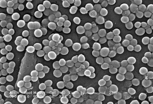 Resistencia a los antibióticos, la "pandemia silenciosa": conoce por qué se produce y cómo frenarla