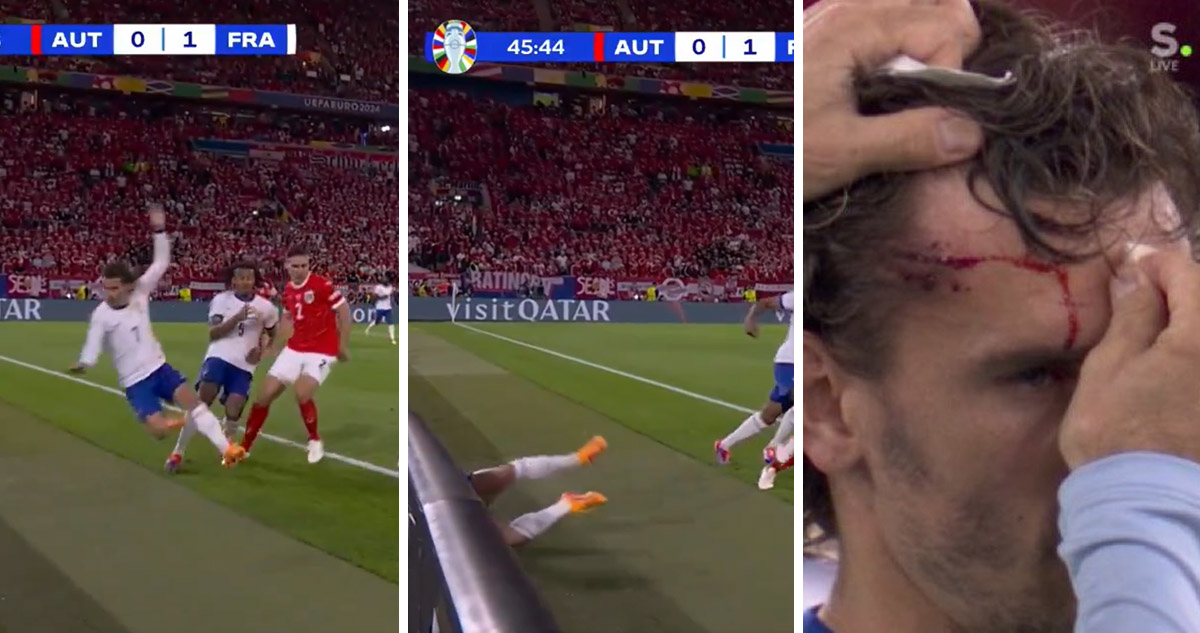 Antoine Griezmann terminó con una gran herida en su frente.