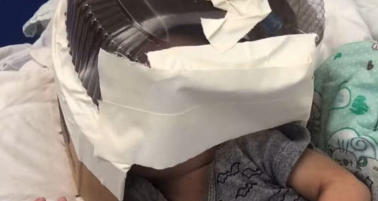 Usan envase de torta en hospital de Brasil como improvisada máscara de oxígeno para un bebé de 3 meses
