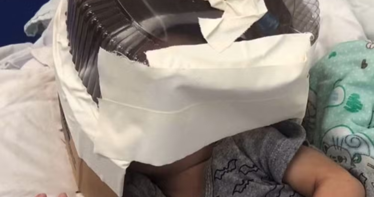 Usan envase de torta en hospital de Brasil como improvisada máscara de oxígeno para un bebé de 3 meses