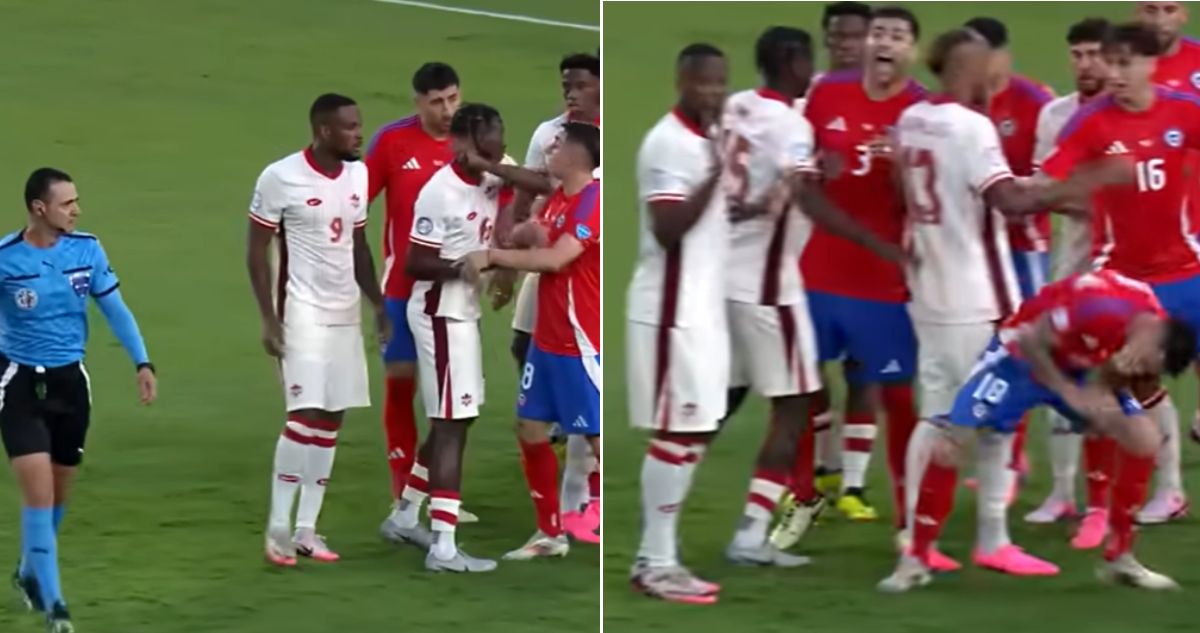 Conmebol admite error por codazo a Echeverría que no fue sancionado ni castigado en Copa América