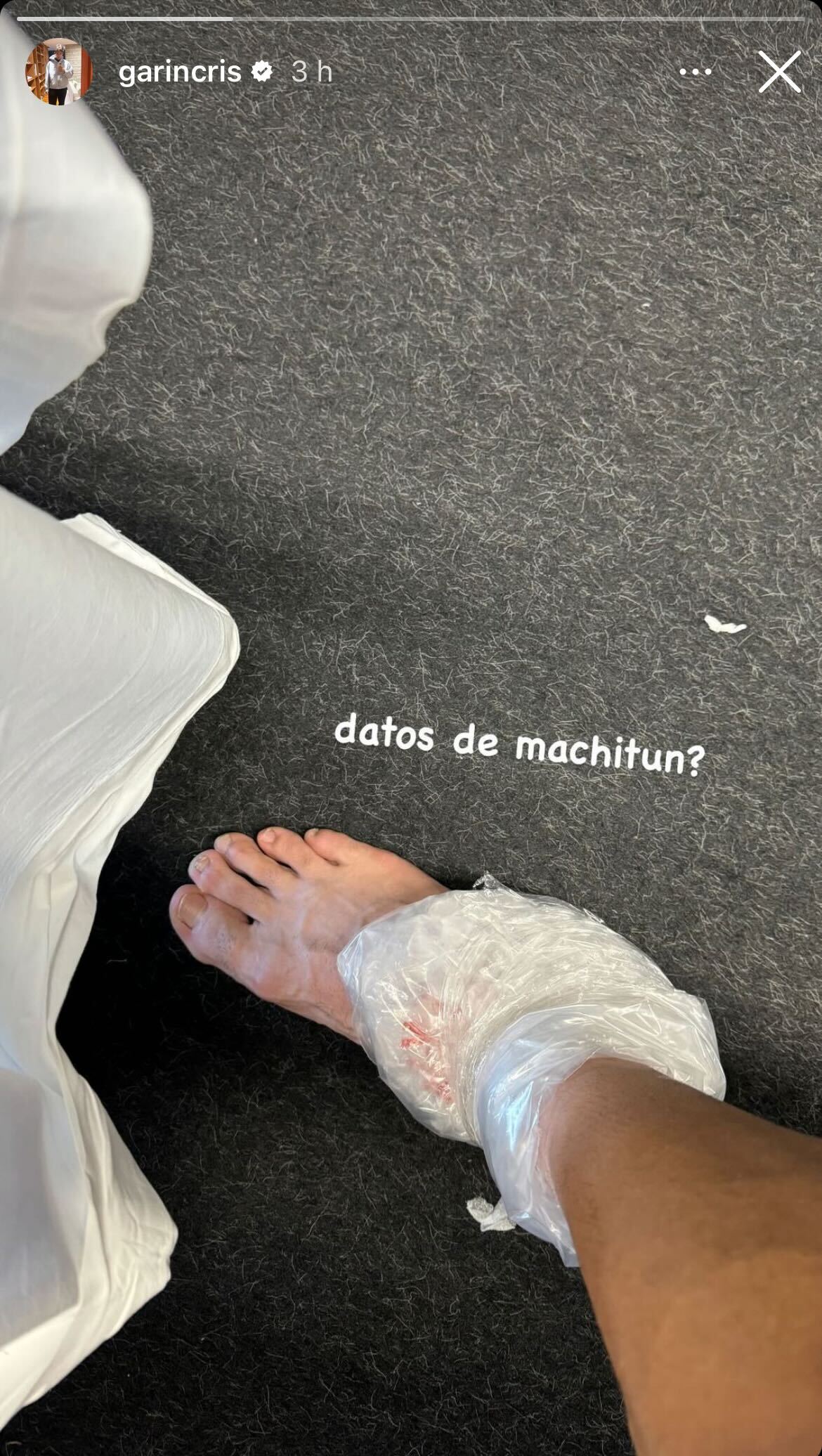 cristian-garin-imagen-lesion.jpg