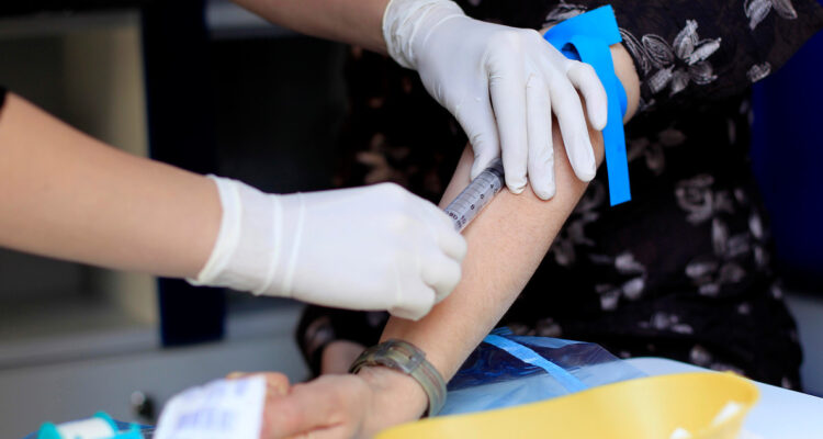 Realizarán mil exámenes de sangre gratuitos para detectar casos de cáncer a la próstata en La Florida