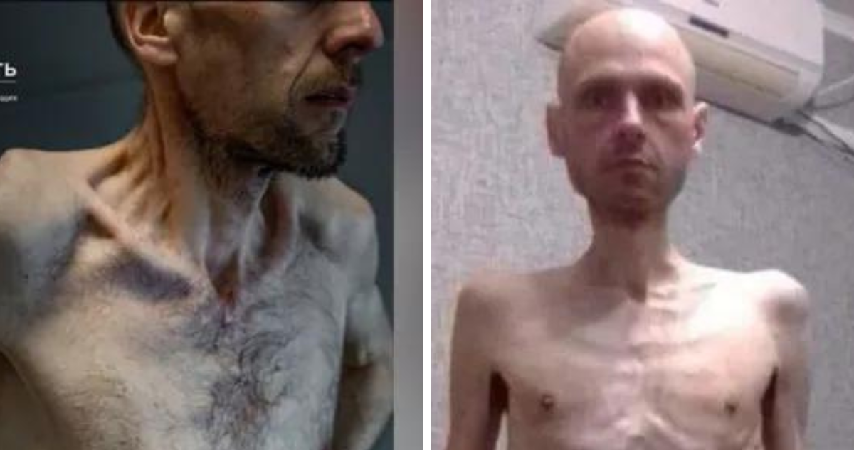 Las impactantes fotos de prisioneros de guerra ucranianos con sus cuerpos demacrados tras liberación
