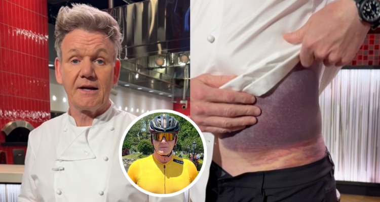 Gordon Ramsay sufrió grave accidente en bicicleta: exhibió sus secuelas en redes y llamó a usar casco