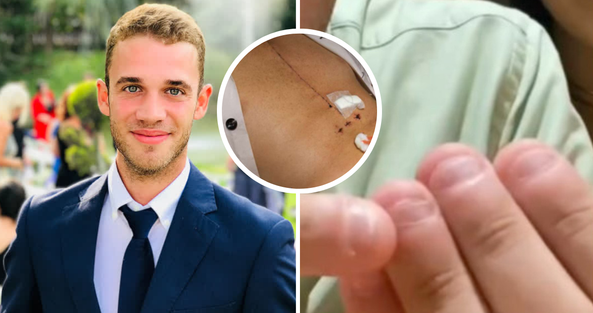 Joven español casi muere comerse las uñas: contrajo grave infección y tuvo que ser operado al corazón