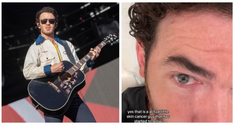 Kevin Jonas revela diagnóstico de cáncer de piel y el tratamiento que tomó: “Revisen esos lunares”