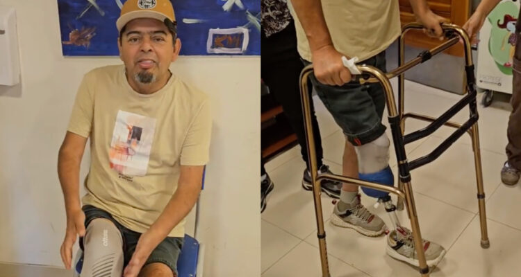 Mauricio Medina mostró cómo se recupera de su amputación: “Gracias a todos los que me han acompañado”