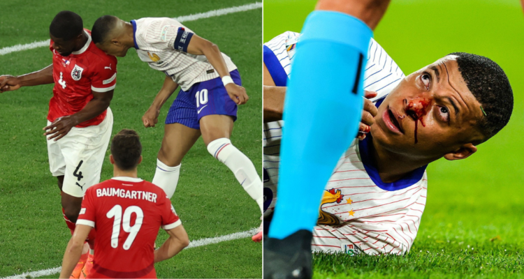 Mbappé sufrió una rotura de nariz y es duda para lo que resta de la Eurocopa.