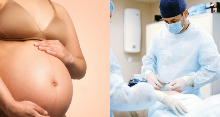 “Mommy makeover”: todo lo que debes saber sobre los cambios de imagen postparto, según expertos
