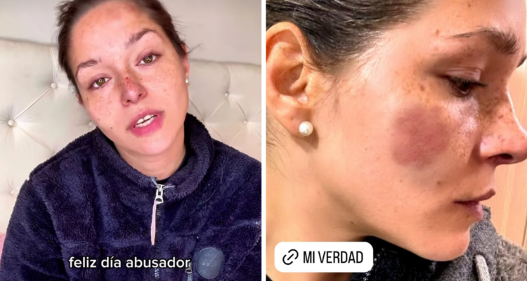 Nicole Block compartió en sus redes sociales, un video donde habla sobre las diversas situaciones de violencia física y psicológica que habría sufrido por parte de su padre.