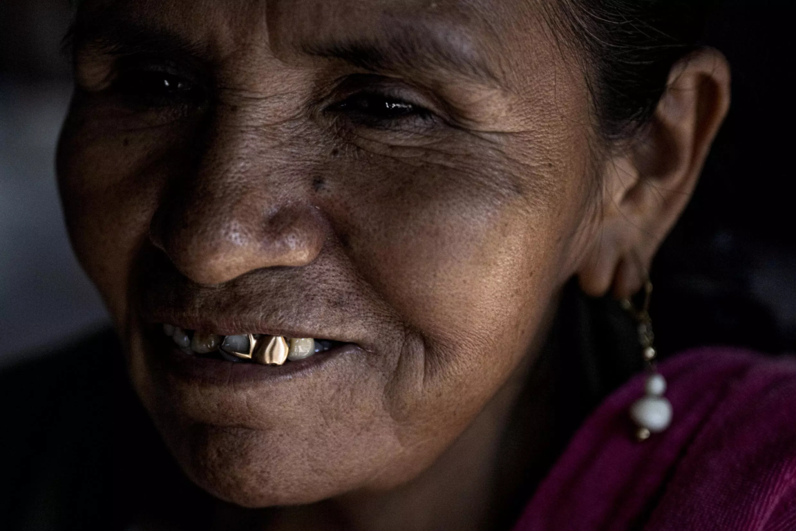 Una mujer sonríe mientras dice que tiene seis gramos de oro en los dientes, en el departamento de Madre de Dios, en la región amazónica del sureste de Perú, el 31 de mayo de 2024.