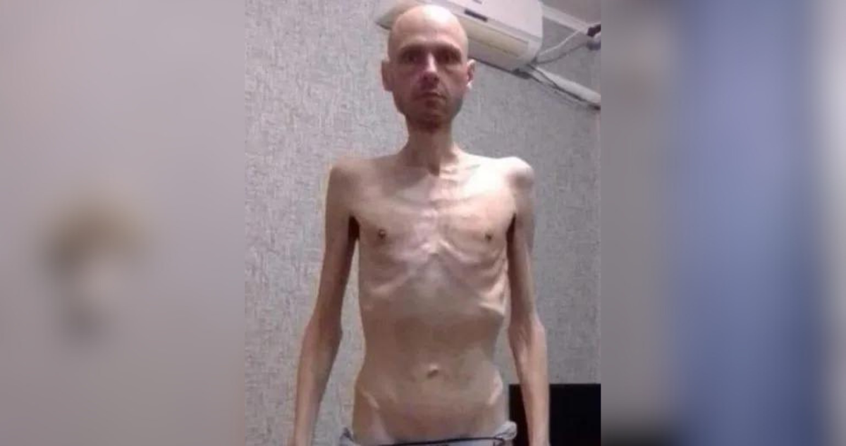 Impactantes imágenes de un prisionero de guerra ucraniano