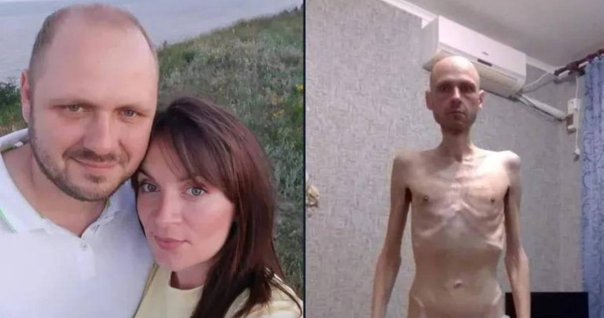 Impactantes imágenes de un prisionero de guerra ucraniano
