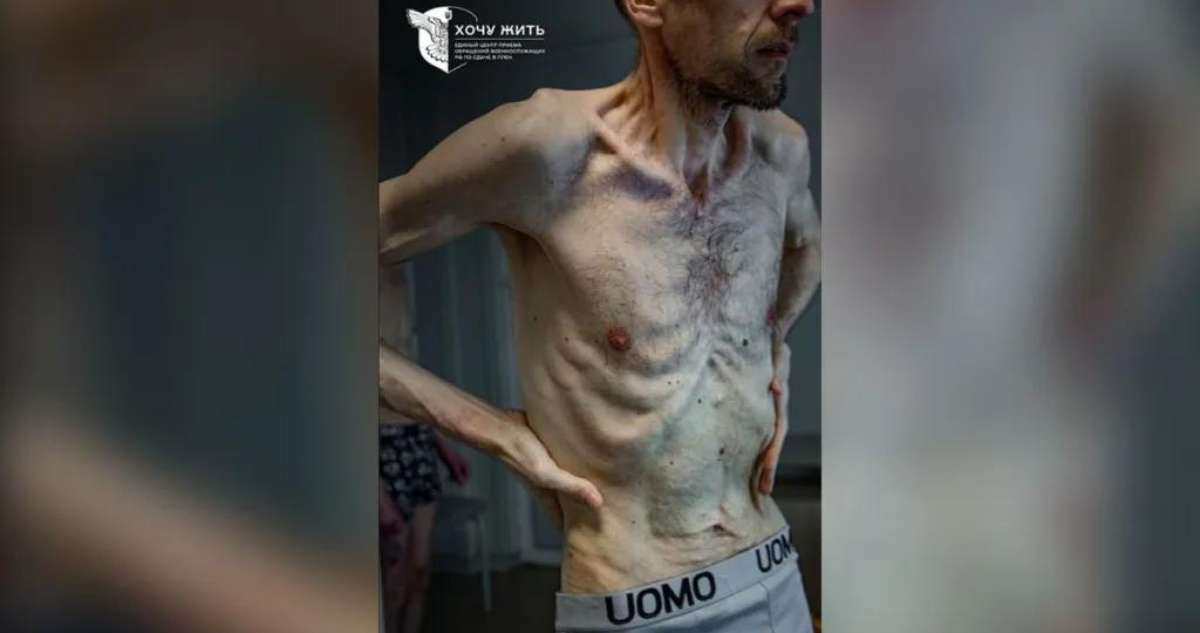 Impactantes imágenes de un prisionero de guerra ucraniano