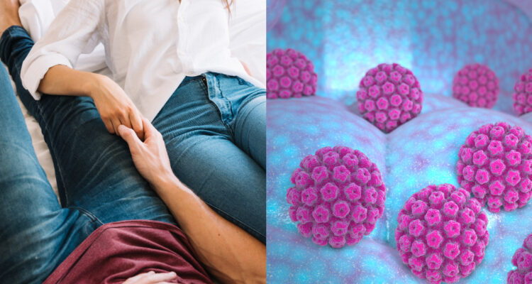 Verrugas genitales y cáncer, los riesgos de contraer Virus del Papiloma Humano (VPH): ¿Cómo tratarlo?