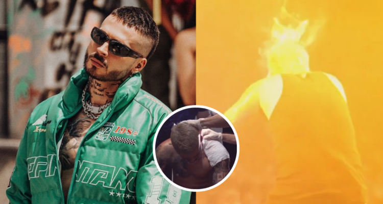 Cantante urbano Reykon sufre accidente durante concierto: parte de su cuerpo se prendió en llamas