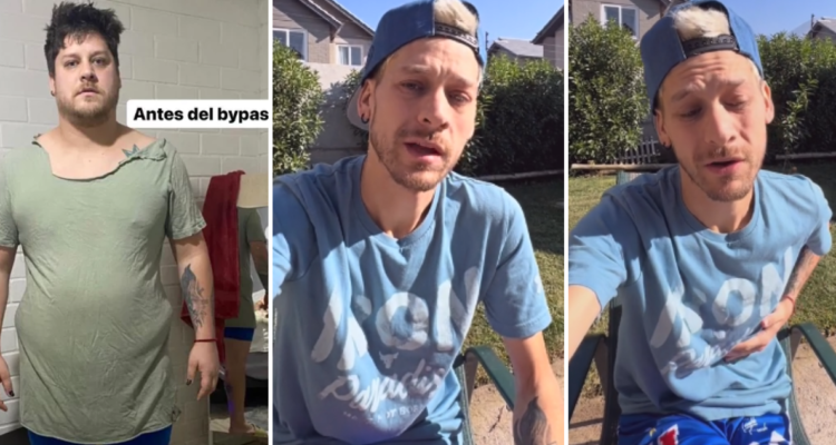 Exchico Yingo, Ariel Osses, reveló problema de salud post bypass gástrico: “No sean tontos como yo”