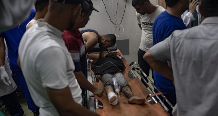 Un niño herido tras el bombardeo israelí espera tratamiento en el Hospital Nasser de Jan Yunis