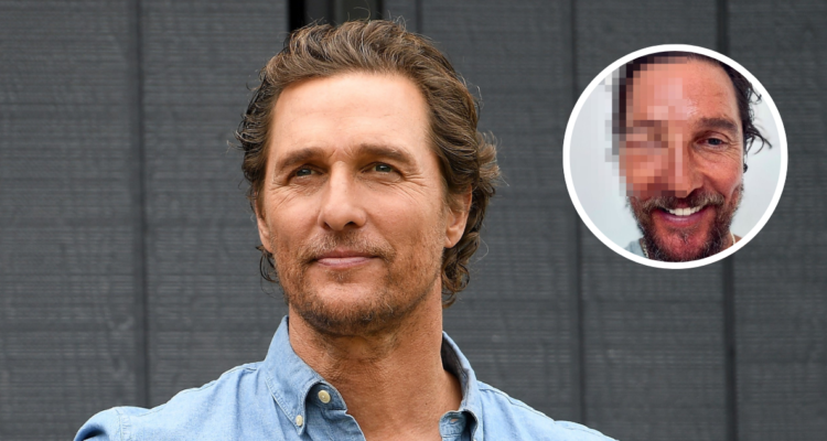 Matthew McConaughey luce irreconocible tras ser picado por una abeja en el rostro