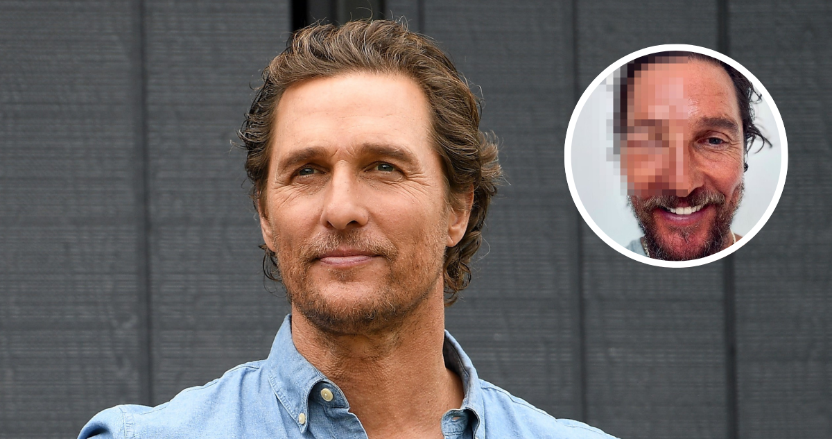 Matthew McConaughey luce irreconocible tras ser picado por una abeja en el rostro
