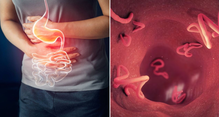 ¿Necesario desparasitarse en Chile?