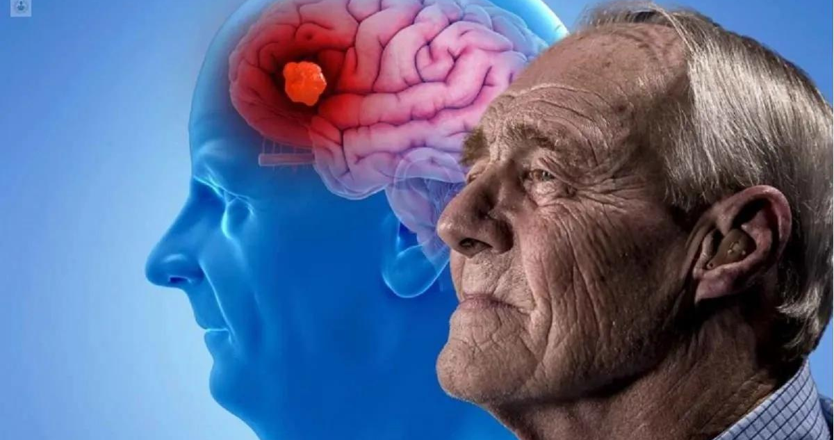 Nuevo tratamiento contra alzheimer