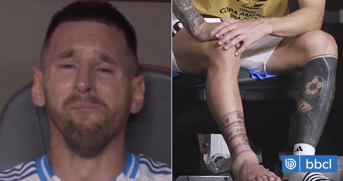 Ya Da La Vuelta Al Mundo La Impactante Foto De Messi Y Su Tobillo Tras Lesionarse En Copa 1004