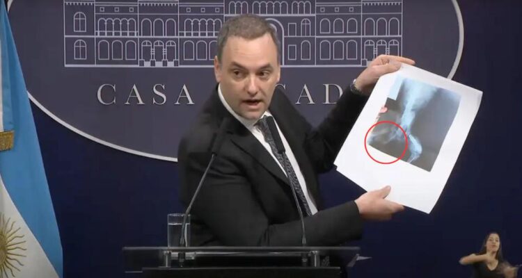 vocero de Milei denuncia uso de radiografías de animales en entrega de pensiones