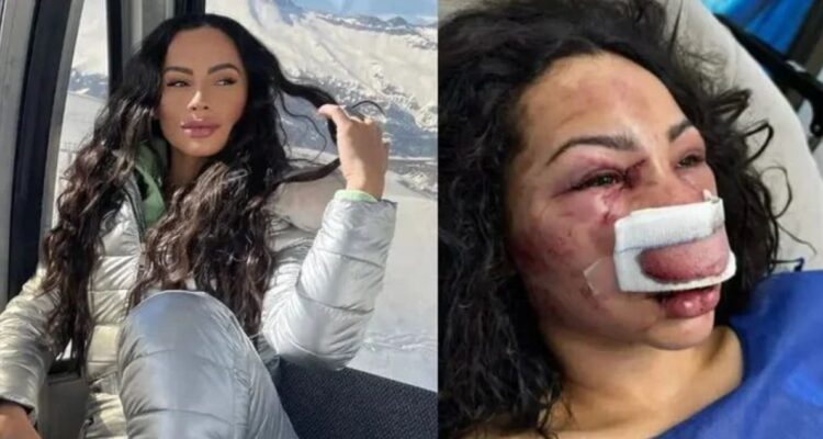 Brasileña espancada