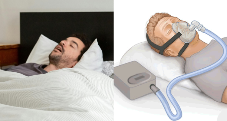 Apnea del sueño: un silencioso peligro que debes identificar y tratar por sus potenciales riesgos