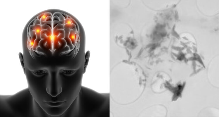 Científicos encuentran microplásticos en el cerebro humano: “Es bastante alarmante”