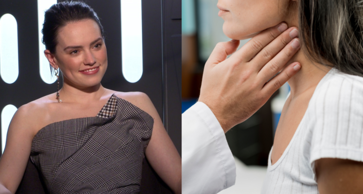 Daisy Ridley, actriz de “Star Wars”, revela diagnóstico de enfermedad de Graves: ¿de qué se trata?