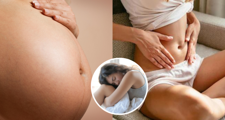 Diástasis abdominal: una frecuente y poco conocida condición que afecta el autoestima tras el embarazo