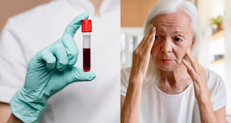 Científicos desarrollan nuevos exámenes de sangre que detectarían Alzheimer un 90% de las veces
