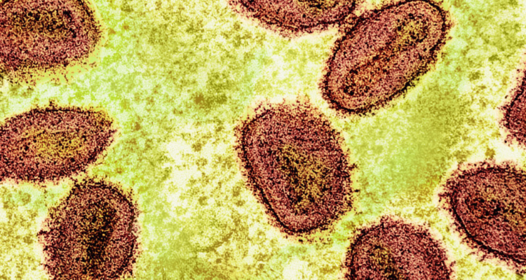 Mpox clado 1B: así es la cepa más contagiosa y mortal de la viruela del mono, causante de nuevos casos