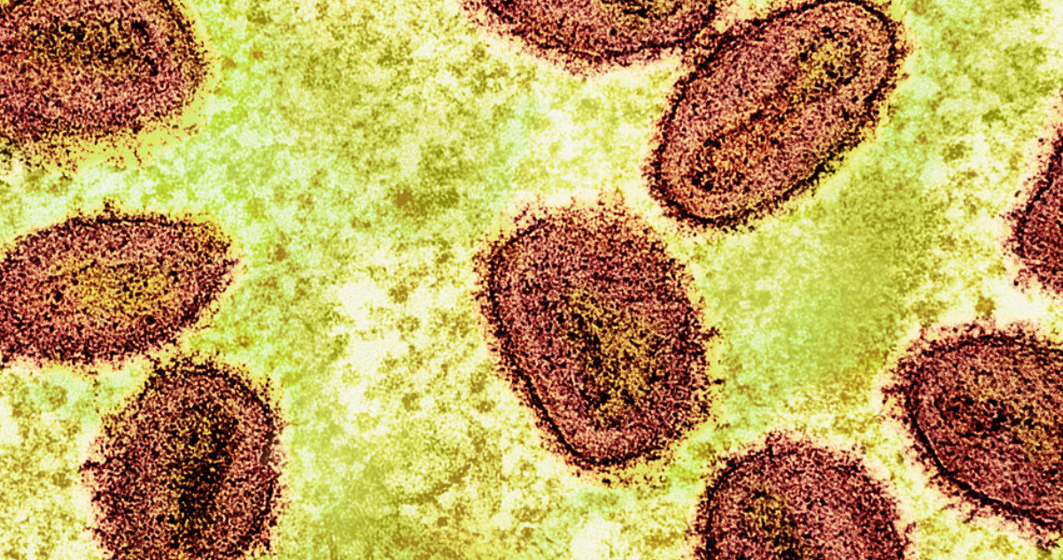 Mpox clado 1B: así es la cepa más contagiosa y mortal de la viruela del mono, causante de nuevos casos