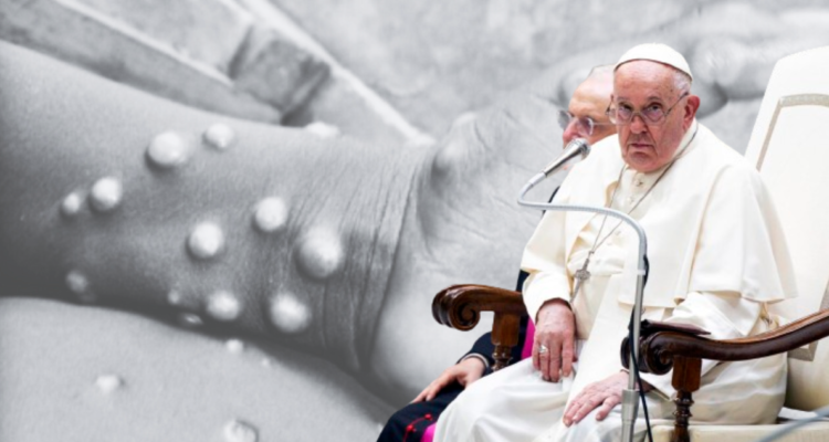 Viruela del mono papa solidariza