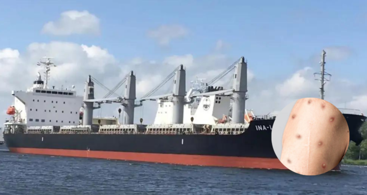 Argentina aísla a buque de Liberia tras detectar síntomas de mpox (viruela del mono) en un tripulante